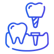 Dental Implant
